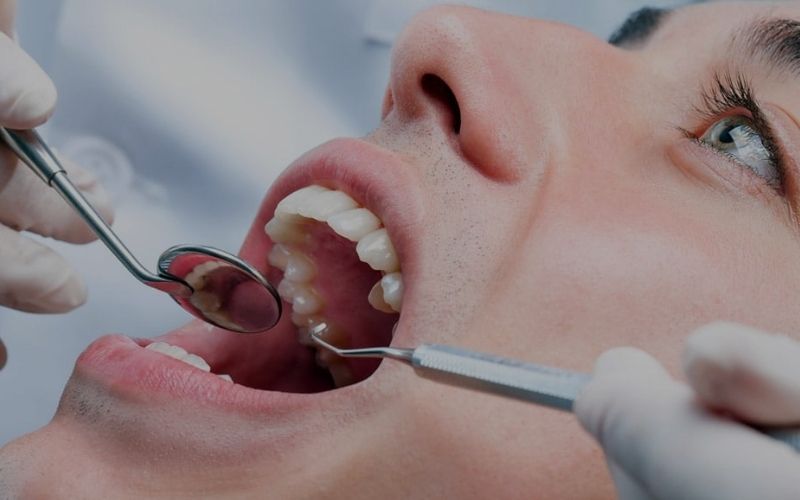 Odontología Conservadora - Murcia | Clínica Dental Pérez Llanes