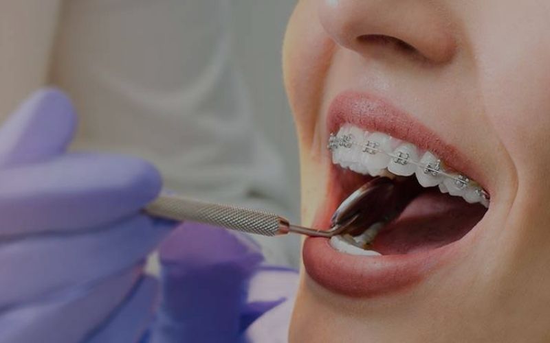 Ortodoncia en Murcia | Clínica Dental Pérez Llanes